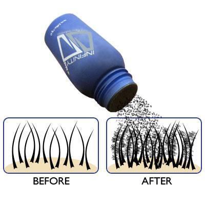Home,Brands,Hair Loss - Infinity Hair Fibers For Thinning Or Balding Hair For Men And Women 28 Gram