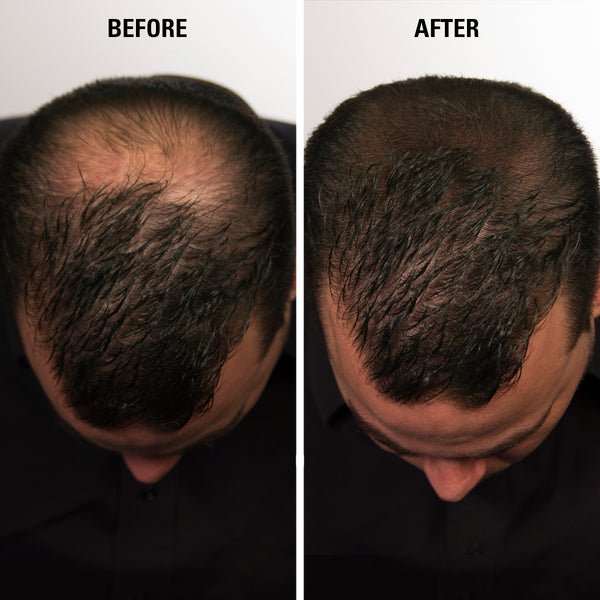 Eclipse Instant Hair Filler