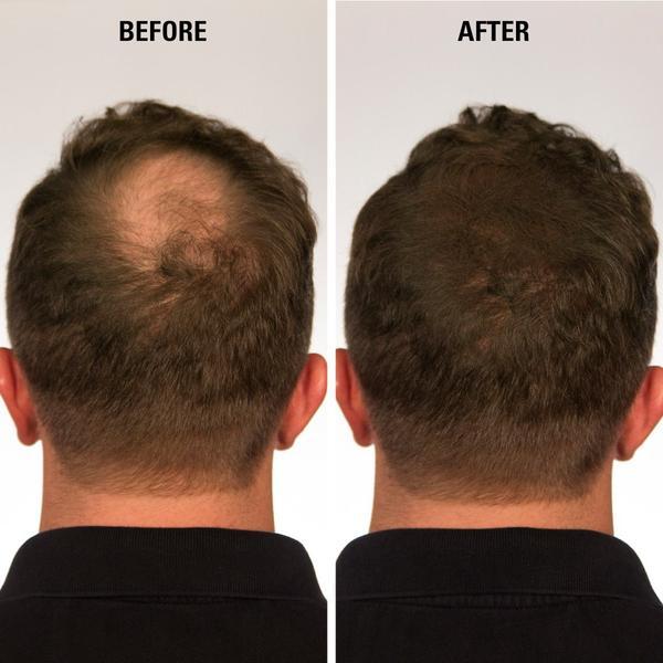 Infinity Hair Fibers 15 gram + Free Pump Applicator
