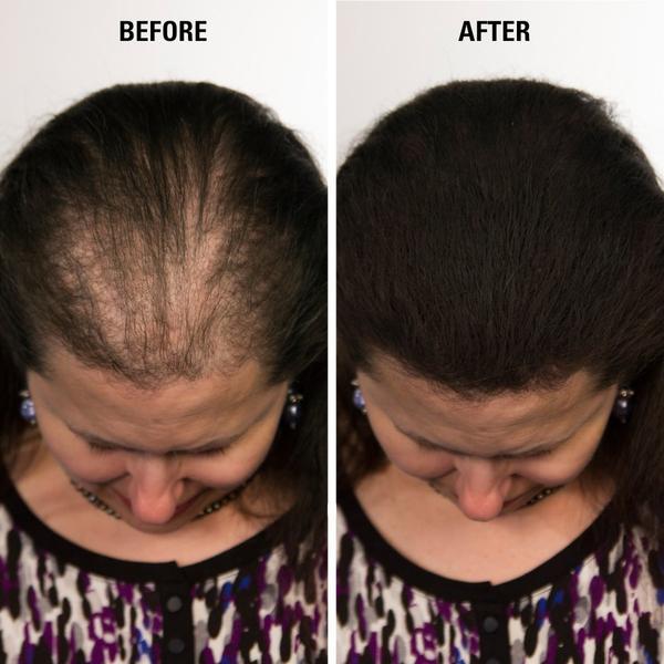 Infinity Hair Fibers 15 gram + Free Pump Applicator