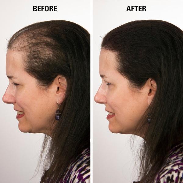 Infinity Hair Fibers 15 gram + Free Pump Applicator
