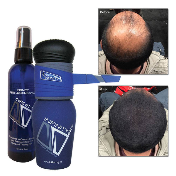 Home,Brands,Hair Loss - Infinity Hair Fibers Hair Loss Concealer + FREE Pump &  Spray